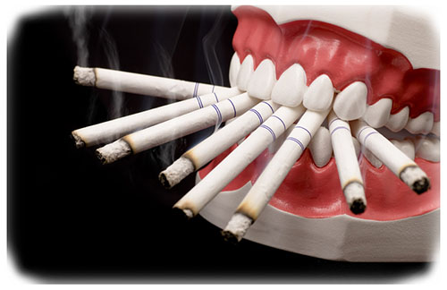 Effects Of Smoking on Oral health