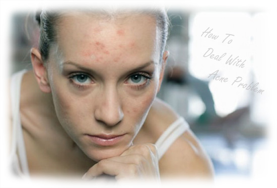 acne problem