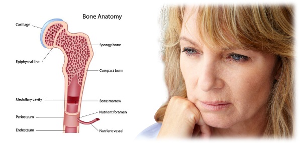menopausel-bone-loss